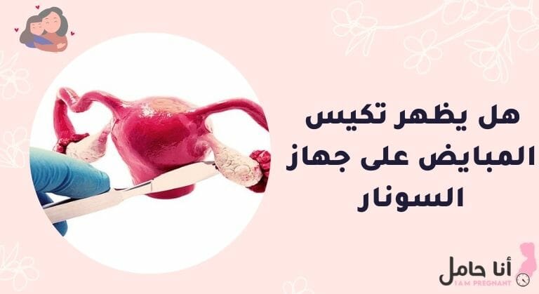 فحص تكيس المبايض بالسونار