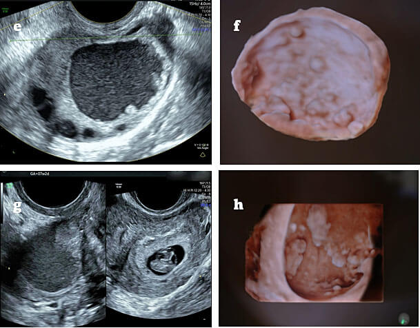 حبوب فيمارا لتنشيط المبايض من جربتها: تجربتنا الكاملة مع فرص الحمل والنتائج المتوقعة