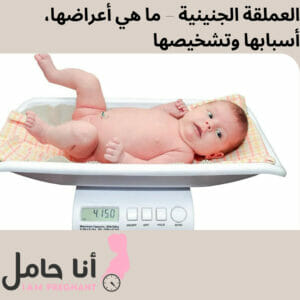 العملقة الجنينية – ما هي أعراضها، أسبابها وتشخيصها