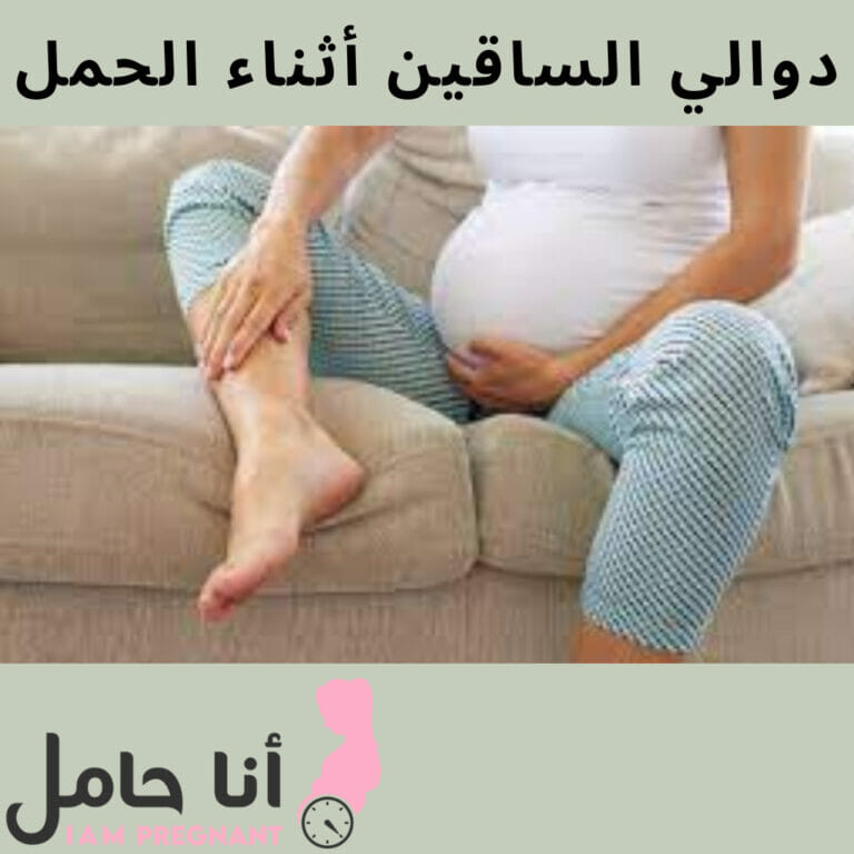 دوالي الساقين أثناء الحمل