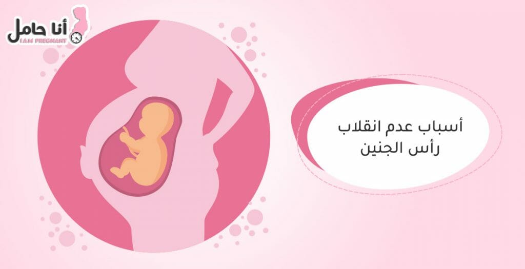 اسباب عدم انقلاب رأس الجنين