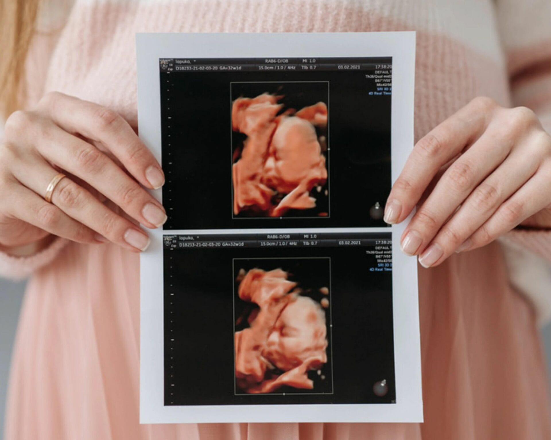 الأسبوع التاسع والثلاثين من الحمل