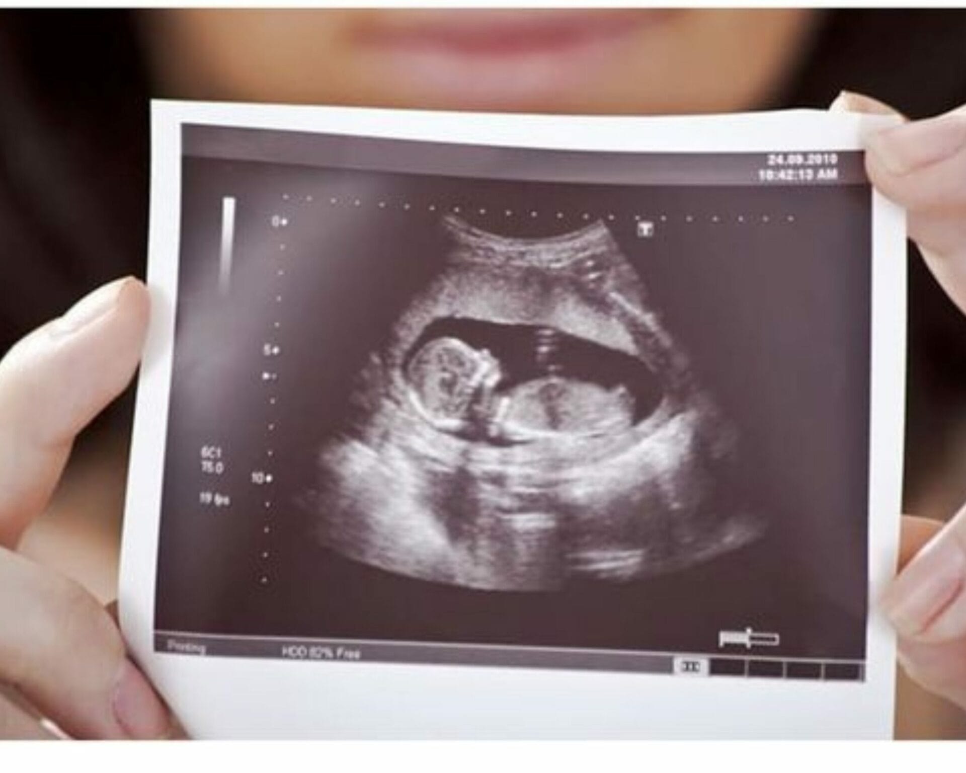 الأسبوع الثالث عشر من الحمل