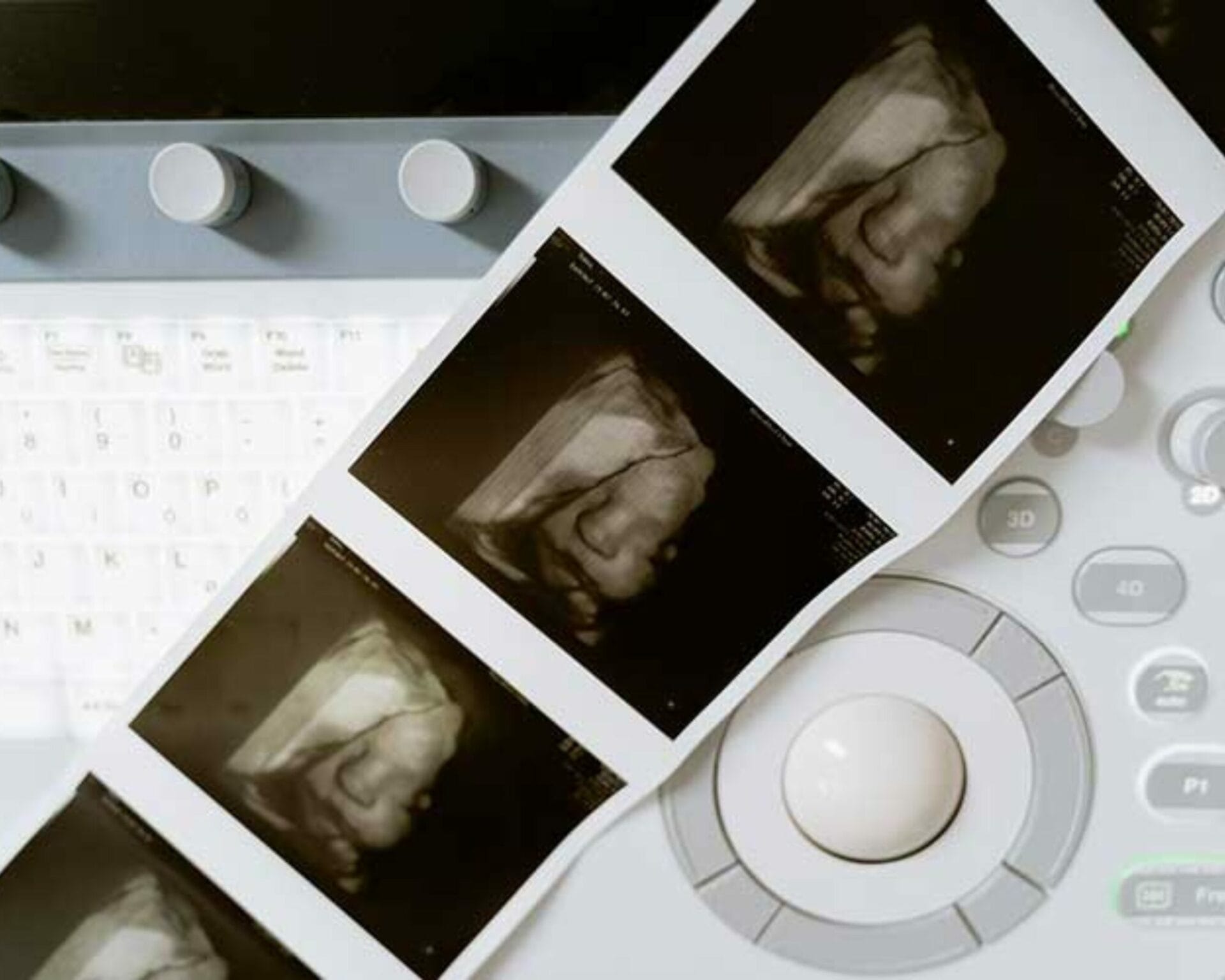 الأسبوع الثاني والأربعون من الحمل