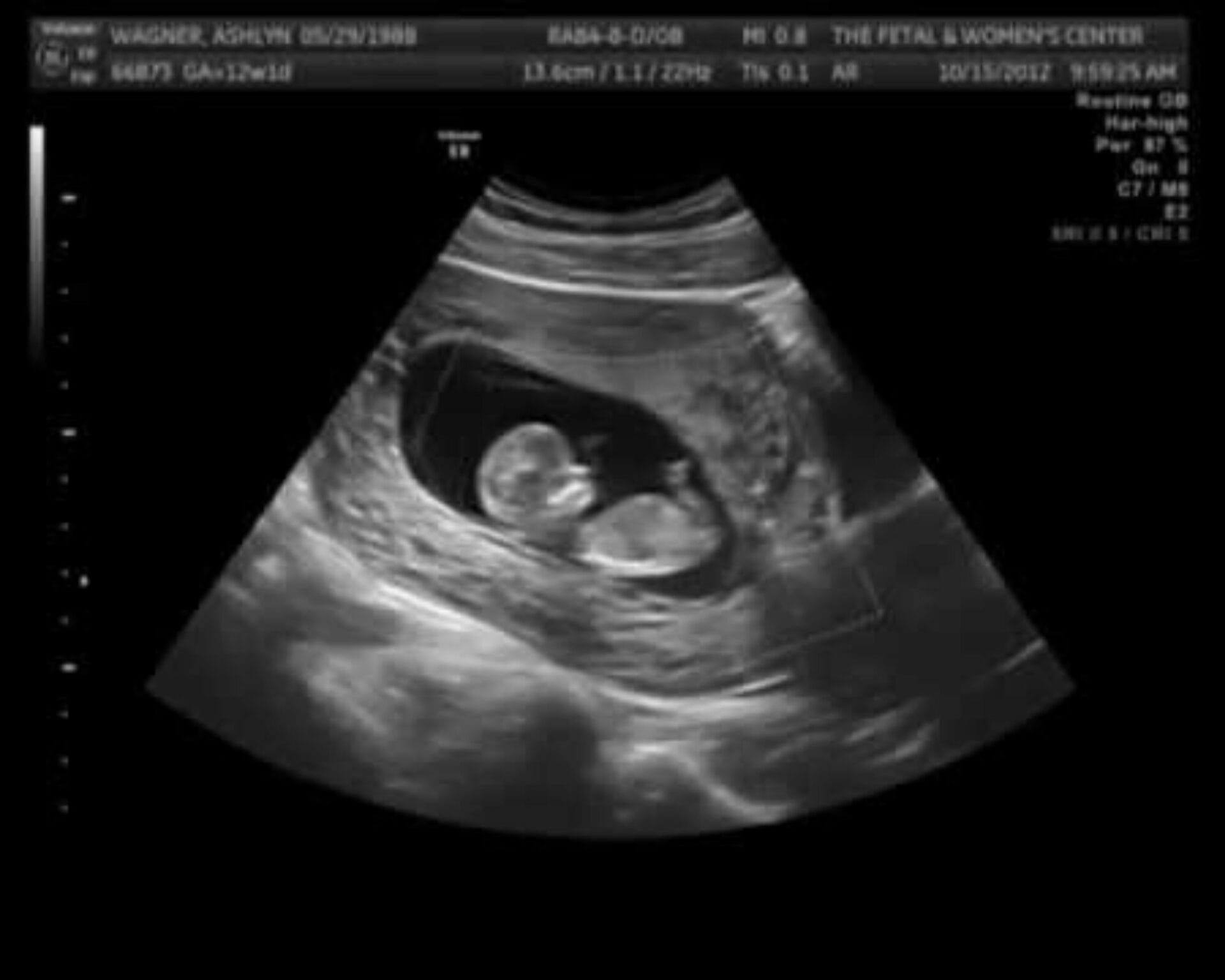 الأسبوع الثاني والعشرون من الحمل