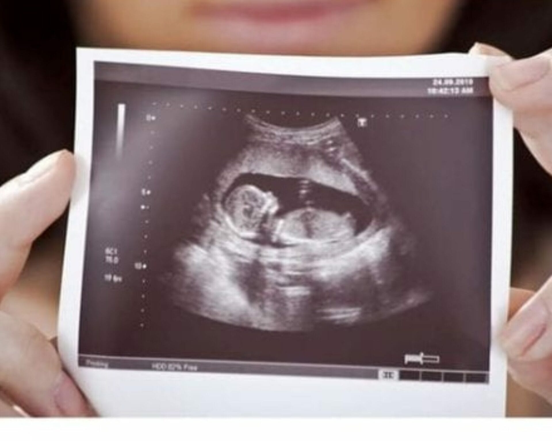 الأسبوع الرابع عشر من الحمل