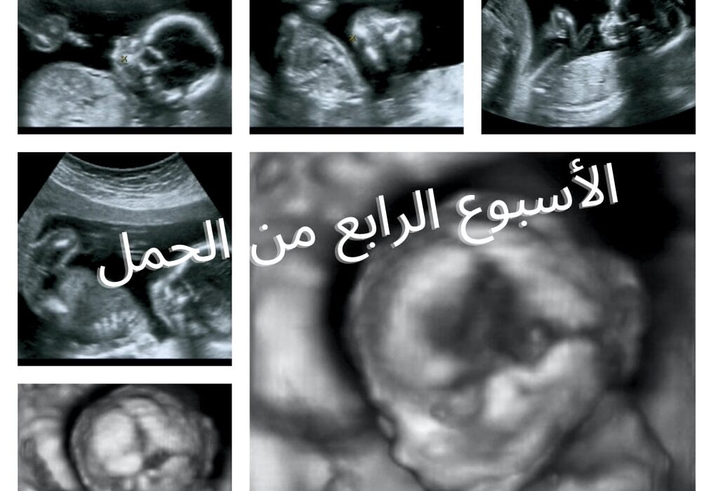 الأسبوع الرابع من الحمل