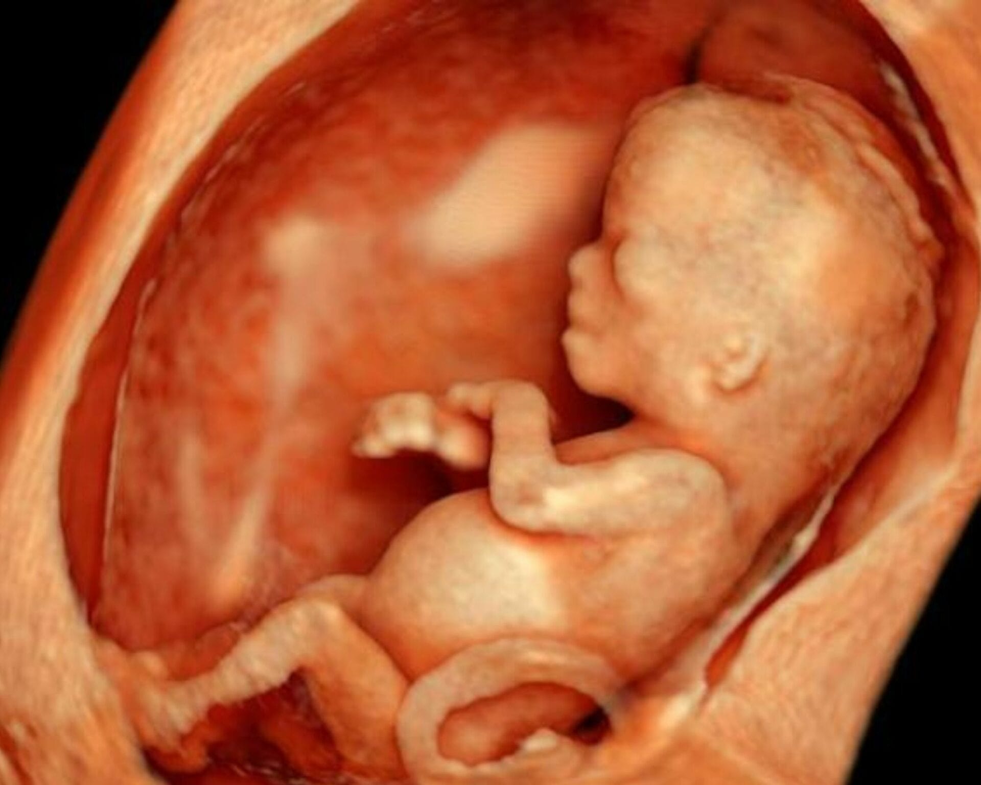 الأسبوع السابع عشر من الحمل