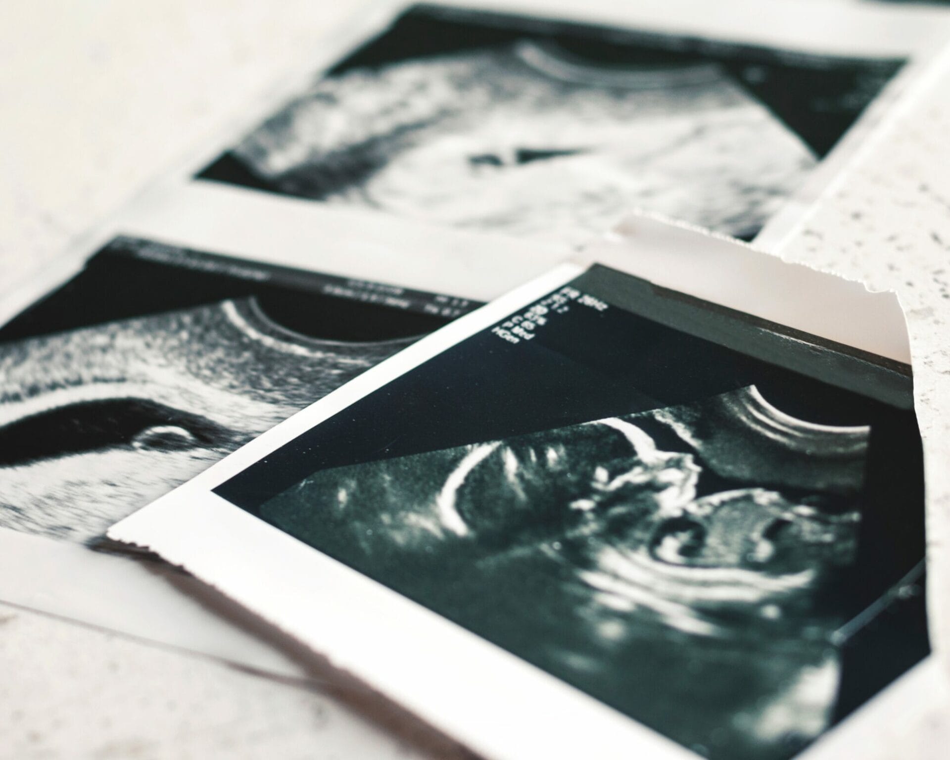 الأسبوع السابع من الحمل