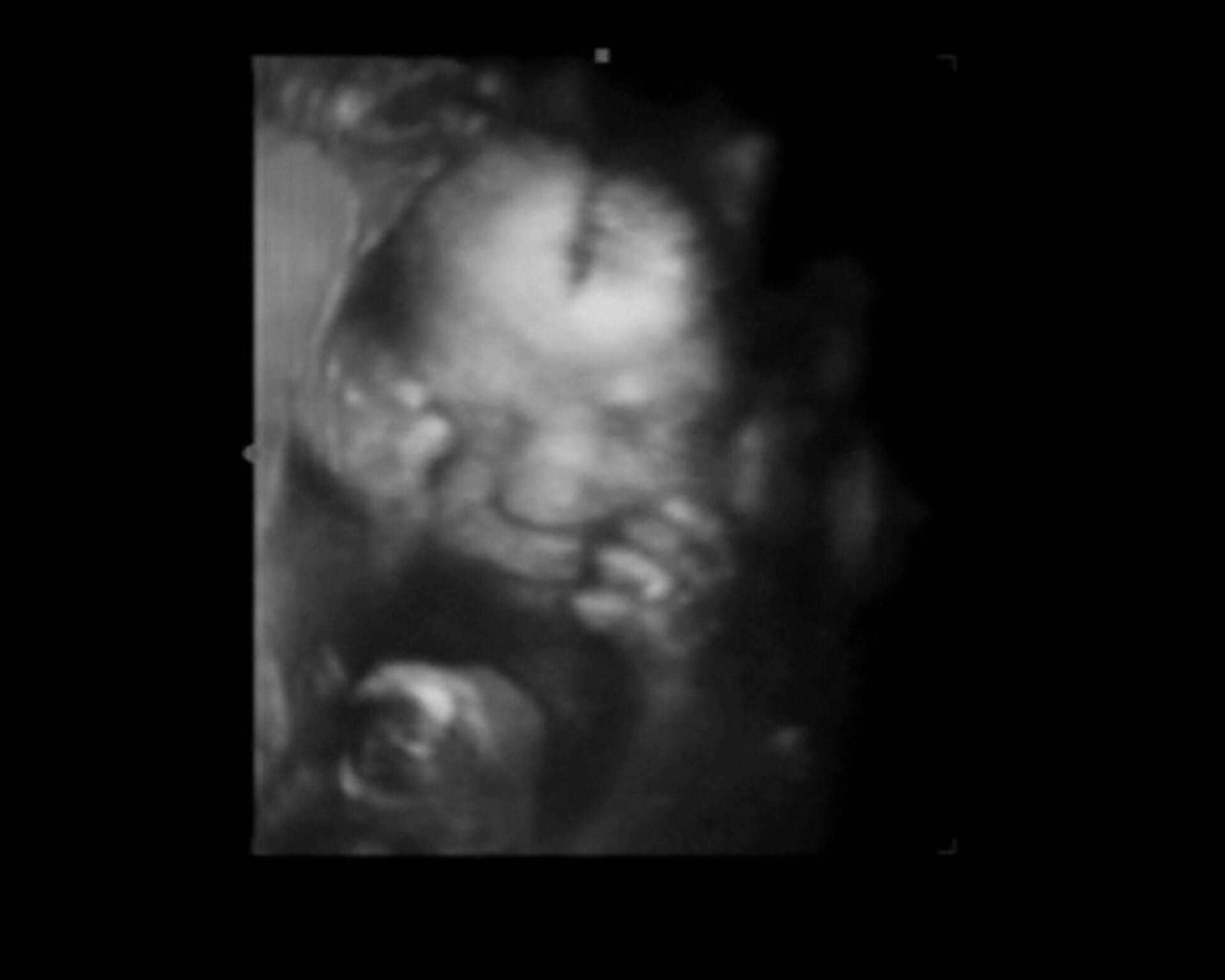 الأسبوع السادس والعشرون من الحمل