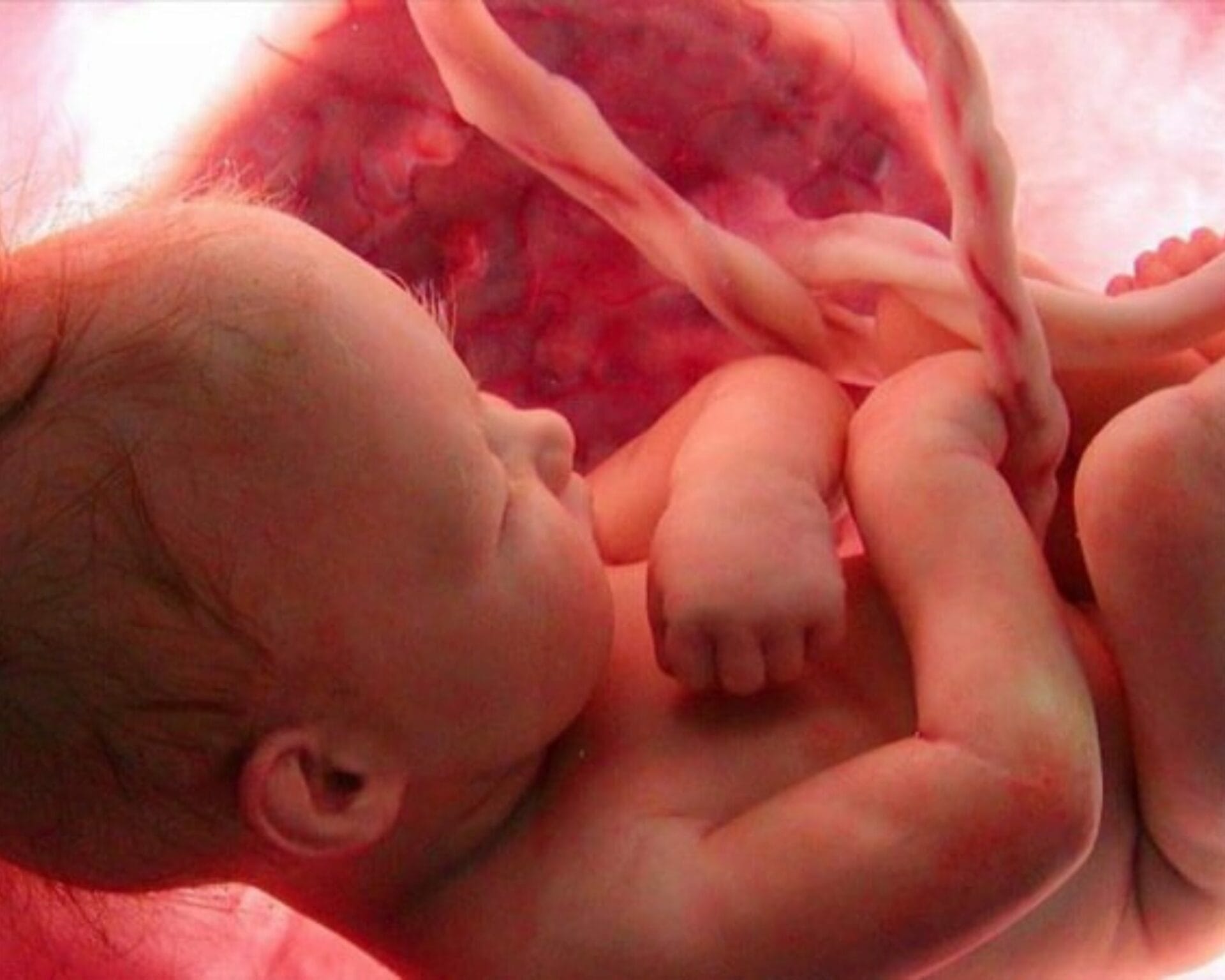 الأسبوع العشرون من الحمل