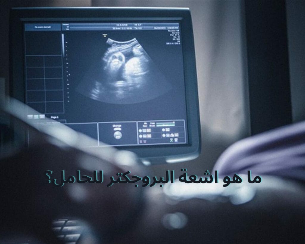 اشعة البروجكتر للحامل