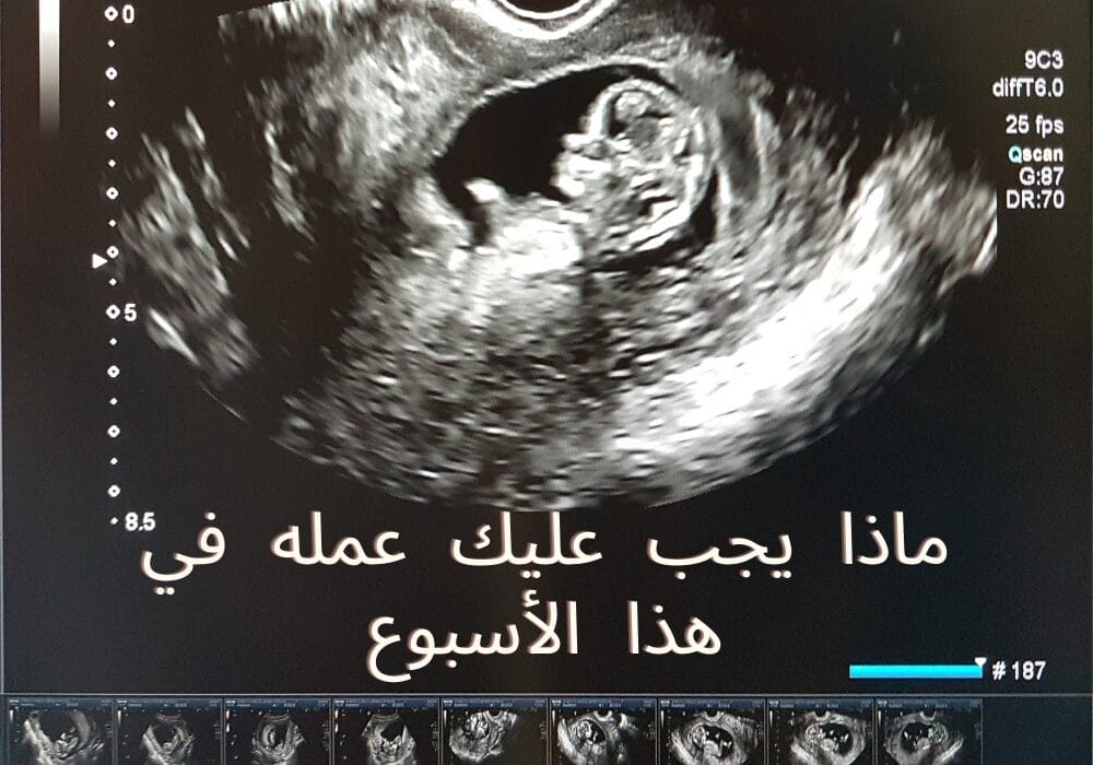 ماذا يجب عليك عمله في هذا الأسبوع