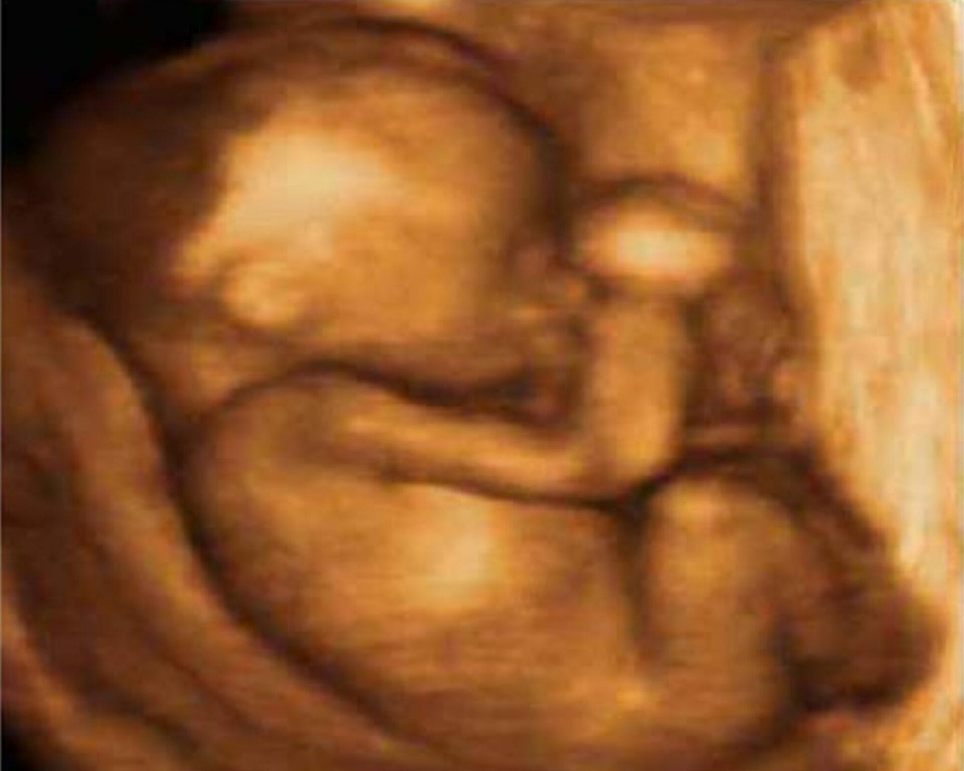 الاسبوع الرابع والعشرين من الحمل