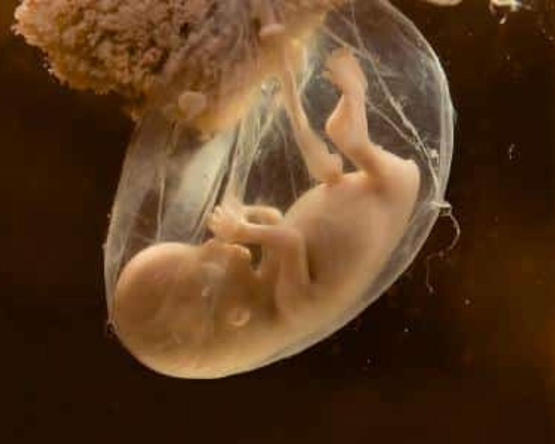 الاسبوع الرابع والعشرين من الحمل