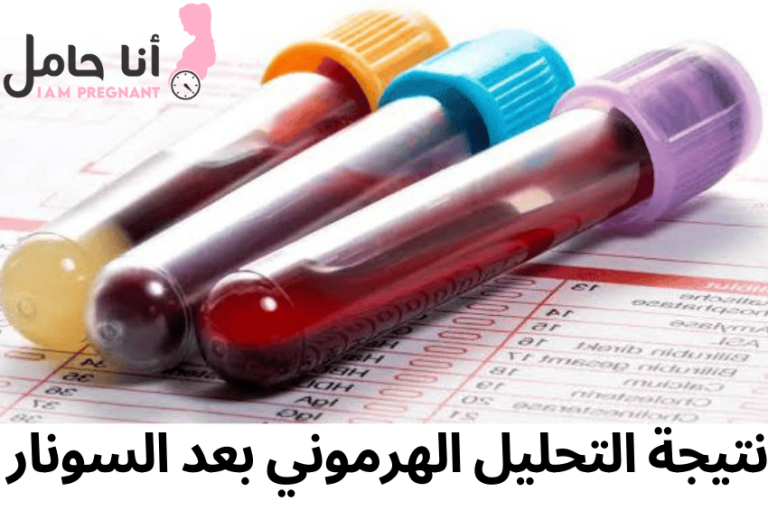 نتيجة التحليل الهرموني بعد السونار اهميتها وانواعها