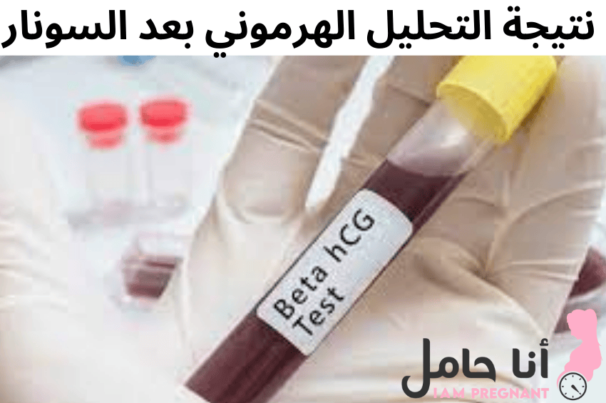 نتيجة التحليل الهرموني بعد السونار