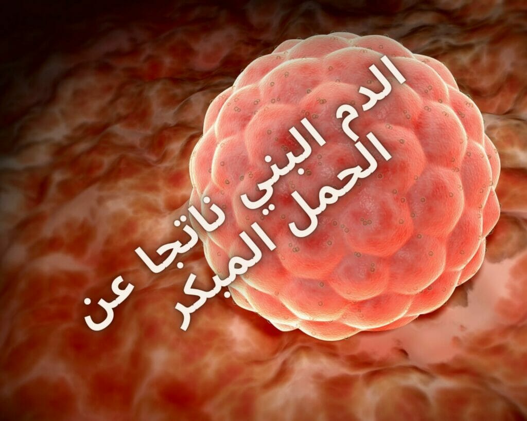  الدم البني ناتجا عن الحمل المبكر