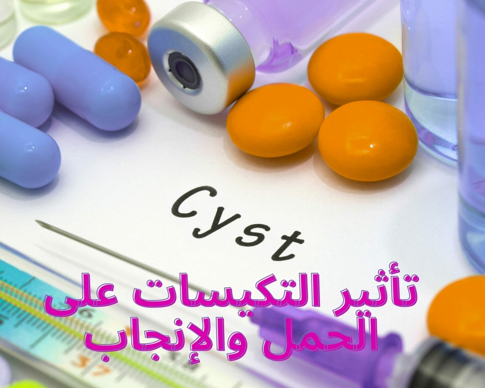 تأثير التكيسات على الحمل والإنجاب
