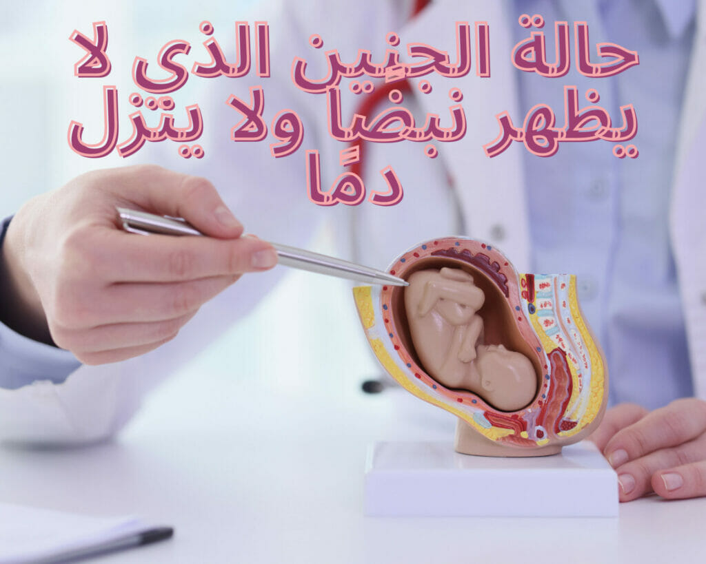 حالة الجنين الذي لا يظهر نبضًا ولا ينزل دمًا