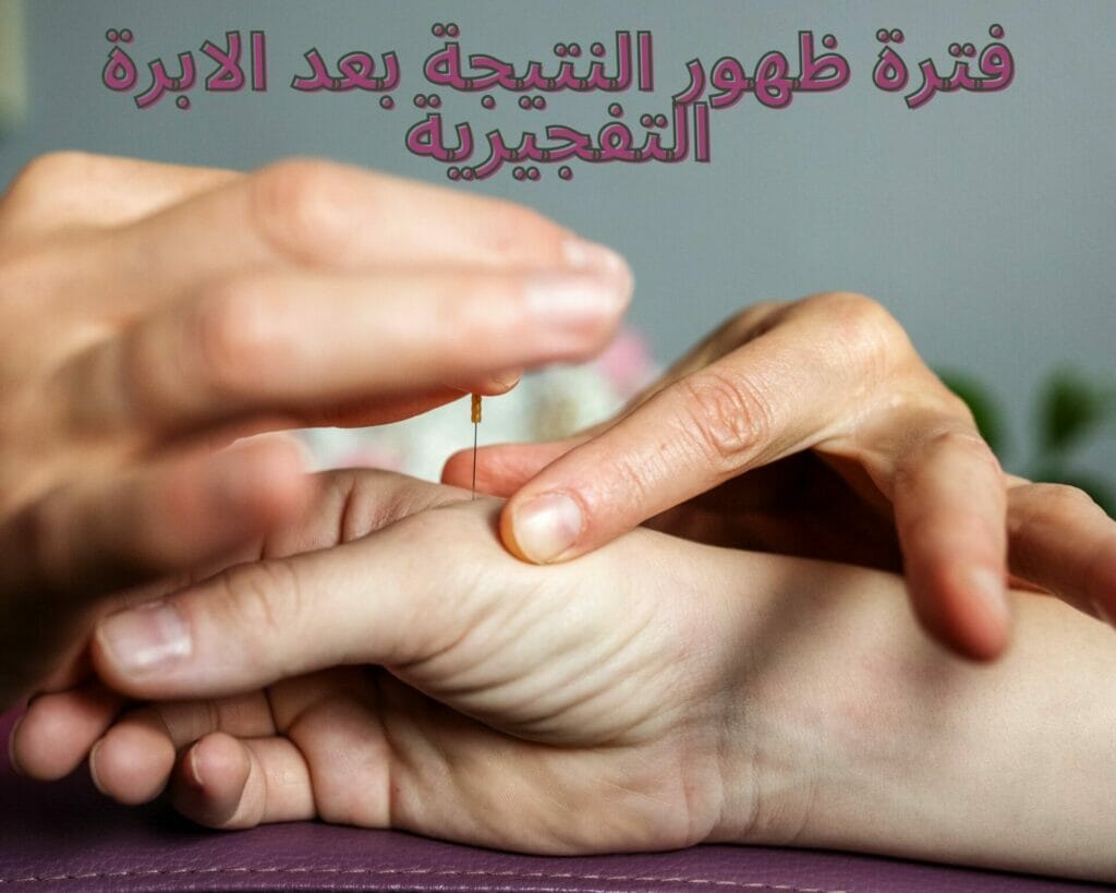 فترة ظهور النتيجة بعد الابرة التفجيرية