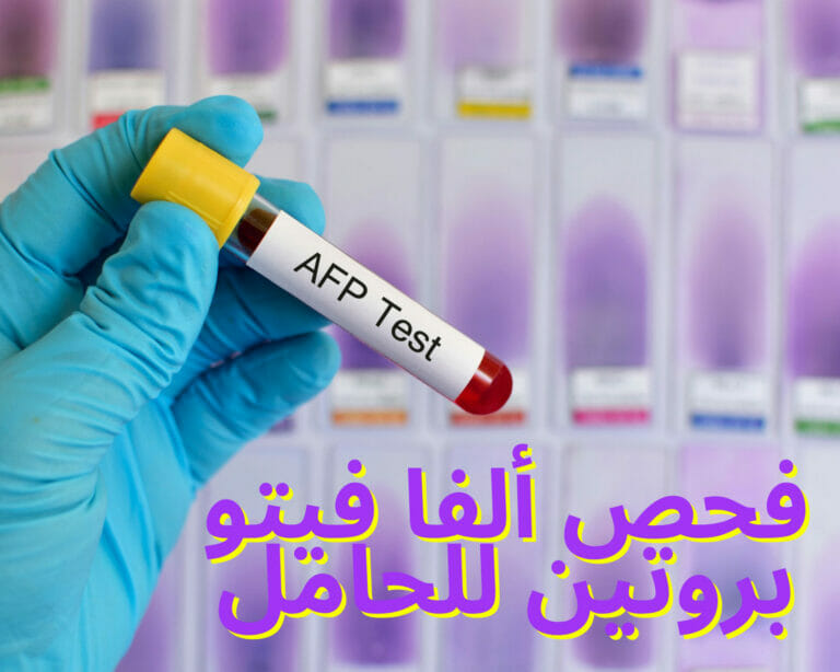 فحص ألفا فيتو بروتين للحامل