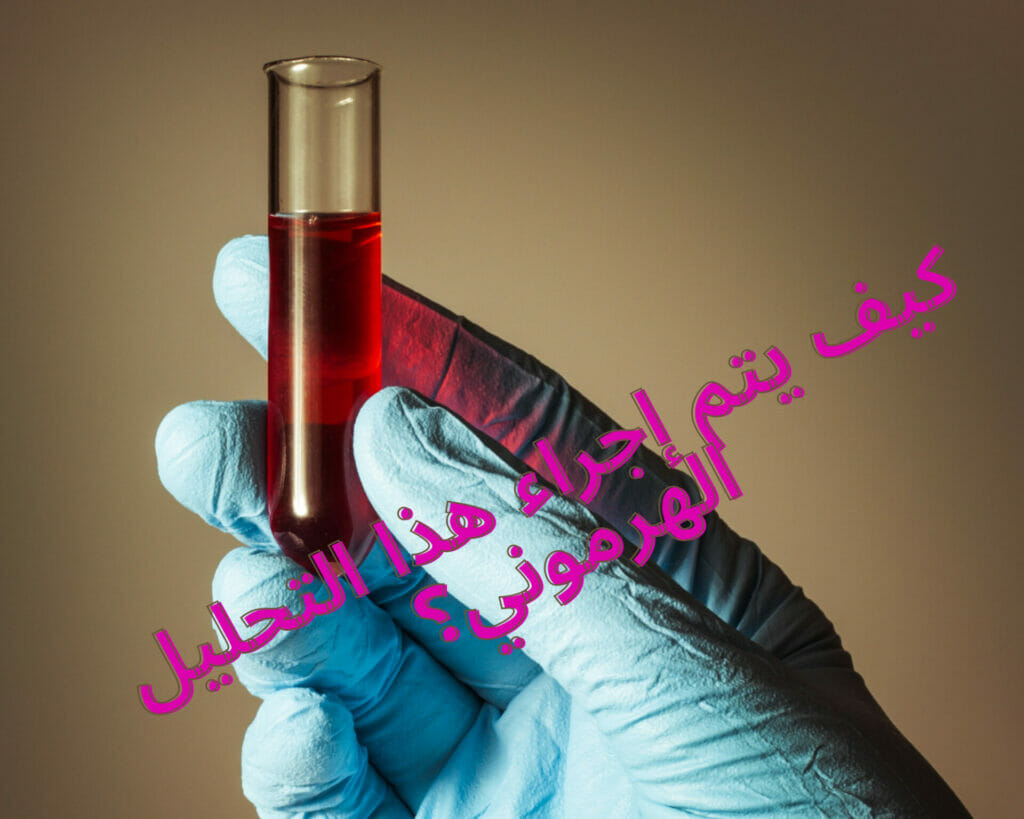 كيف يتم إجراء هذا التحليل الهرموني؟