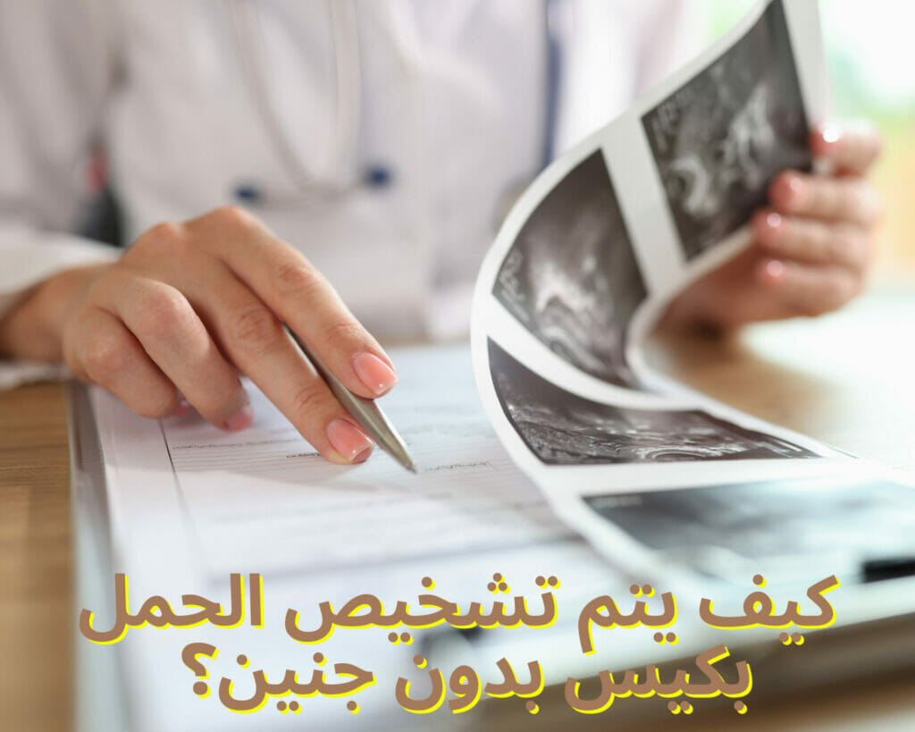 كيف يتم تشخيص الحمل بكيس بدون جنين؟