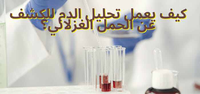 كيف يعمل تحليل الدم للكشف عن الحمل الغزلاني؟