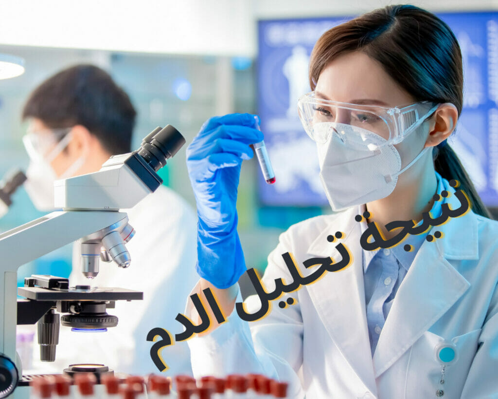 نتيجة تحليل الدم