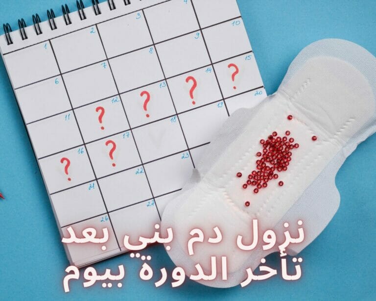 نزول دم بني بعد تأخر الدورة بيوم
