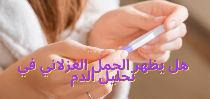 هل يظهر الحمل الغزلاني في تحليل الدم