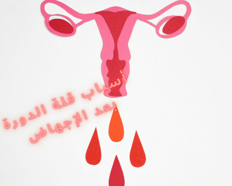 أسباب قلة الدورة بعد الإجهاض