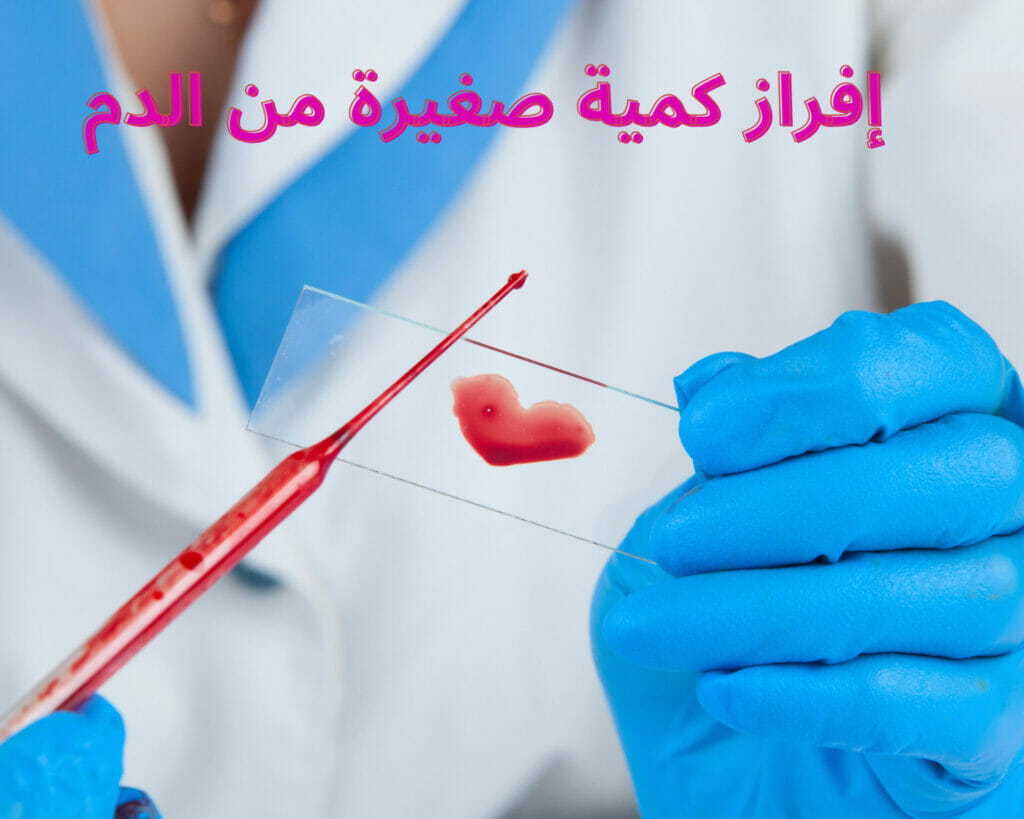 إفراز كمية صغيرة من الدم