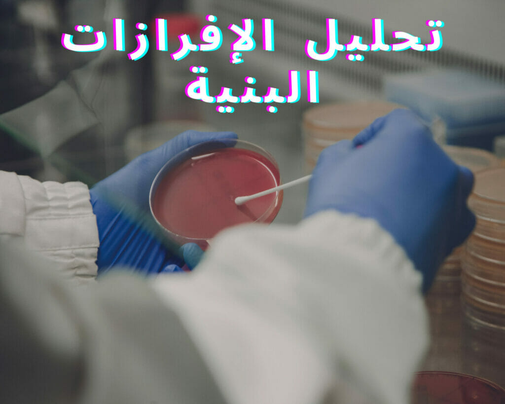 تحليل الإفرازات البنية