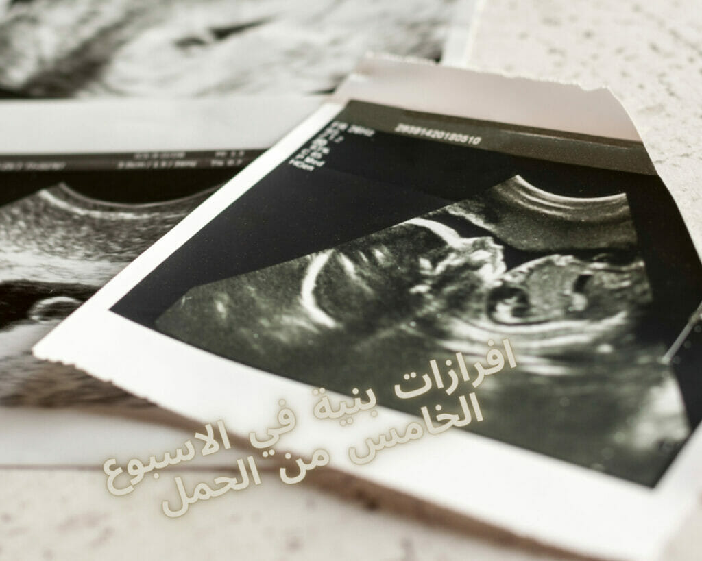 افرازات بنية في الاسبوع الخامس من الحمل