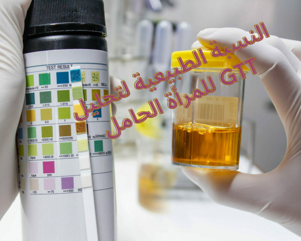 نتيجة تحليل سكر الحمل