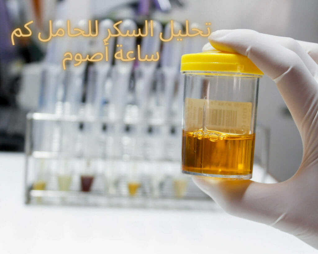 نتيجة تحليل سكر الحمل