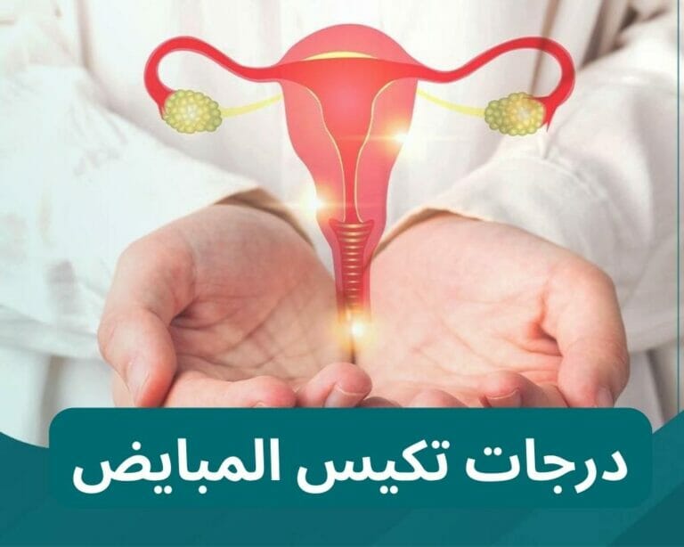 درجات تكيس المبايض تصنيف المرض وفقًا لدرجة الصعوبة