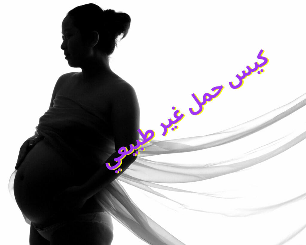 كيس حمل غير طبيعي