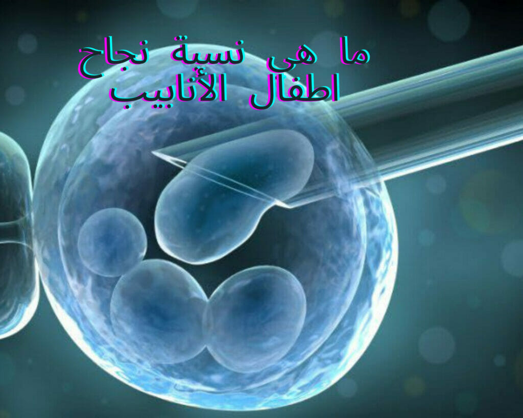 ما هي نسبة نجاح اطفال الأنابيب
