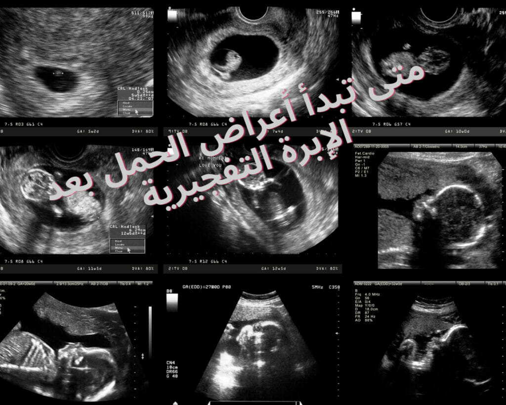 الابرة التفجيرية والحمل