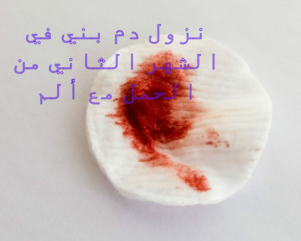 نزول دم في الشهر الثاني من الحمل مع ألم