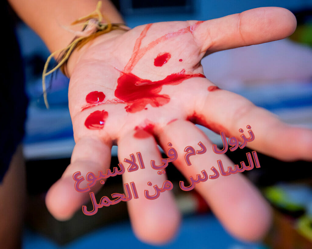 نزول دم في الاسبوع السادس من الحمل