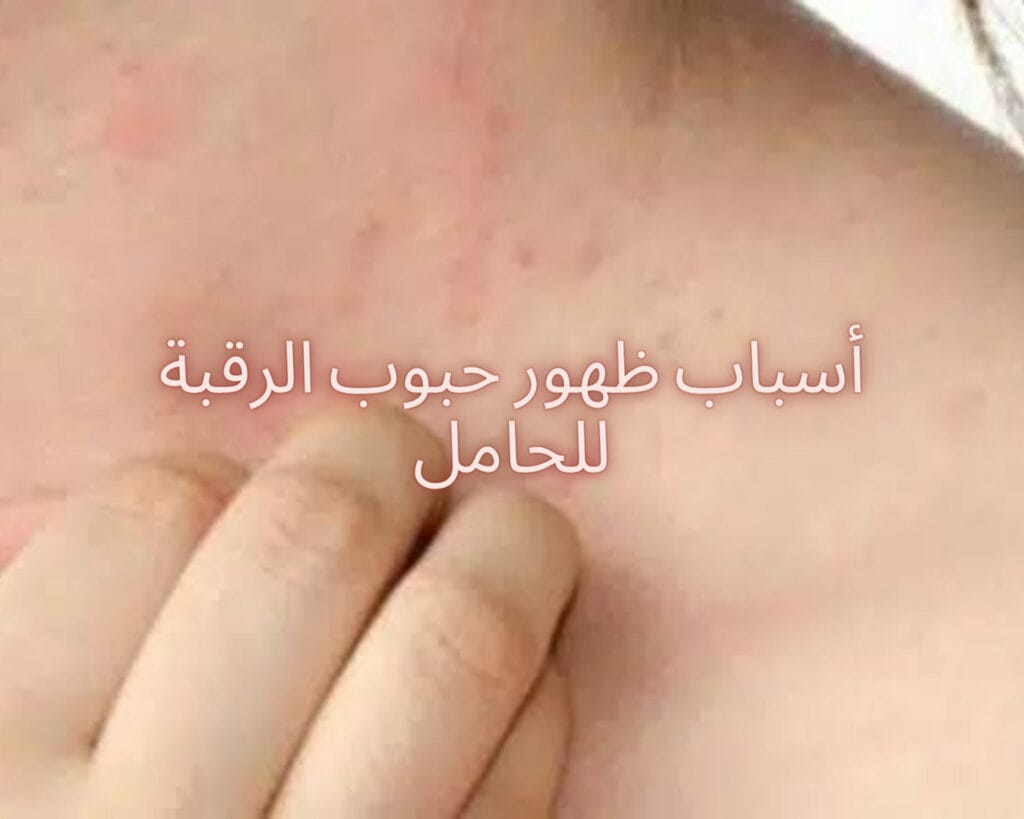 حبوب في الرقبة للحامل