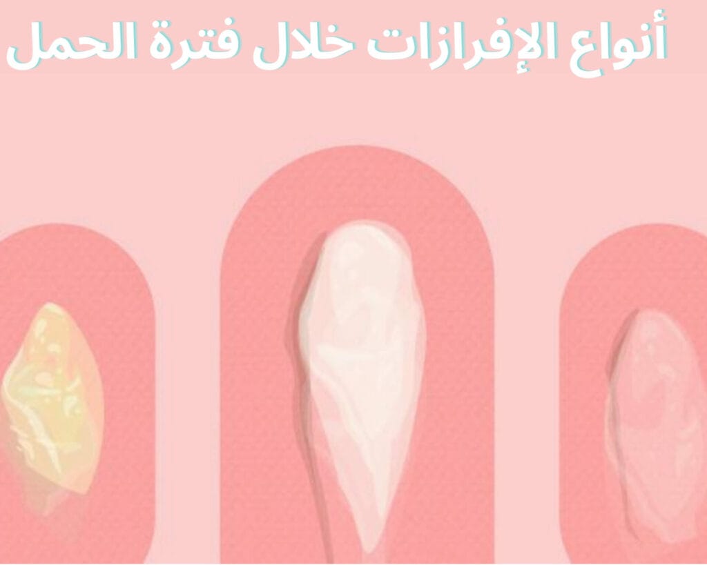 حامل وينزل افرازات وردية