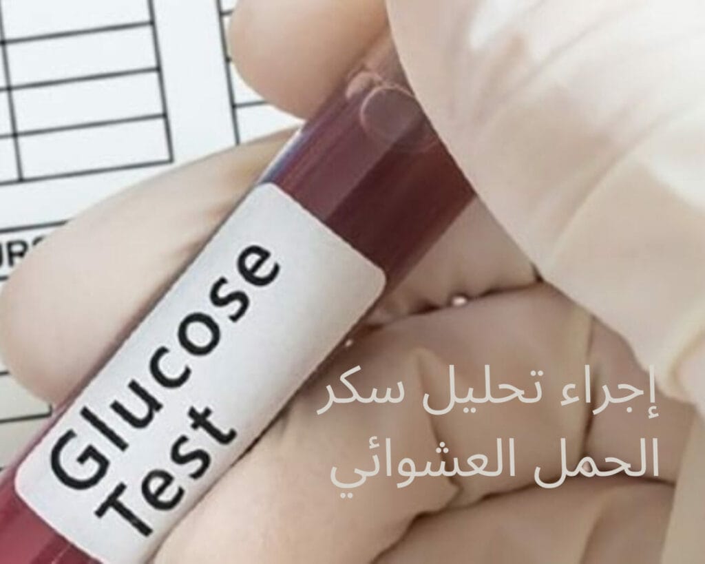 تحليل سكر الحمل العشوائي