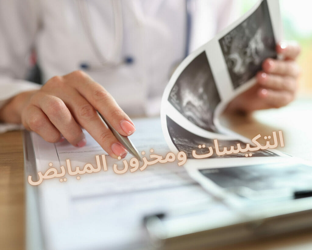 التكيسات ومخزون المبايض 