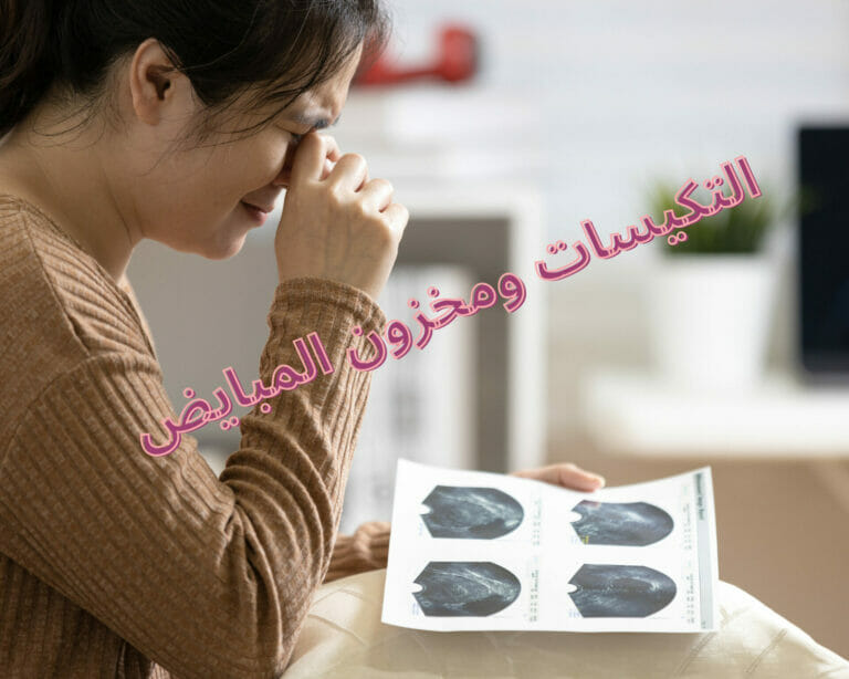 التكيسات ومخزون المبايض