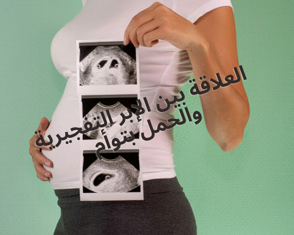 الإبر التفجيرية للحمل